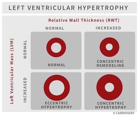 Understanding LVH Part 2: How to Measure LV Mass and 